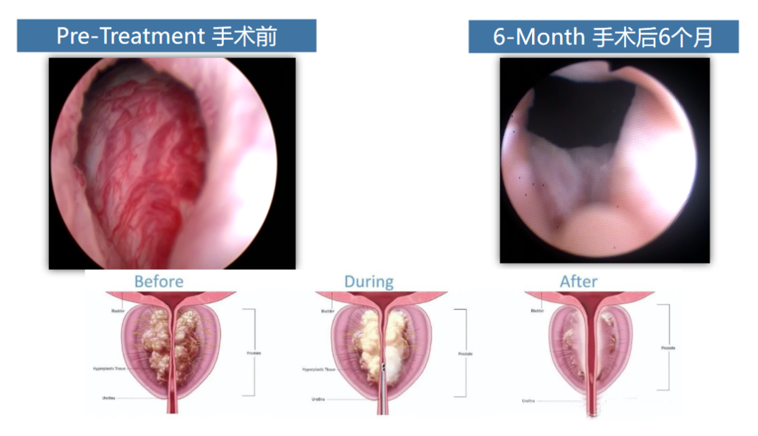 聚焦技术前沿，四川结石病医院Rezūm瑞梦培训中心第一期培训班圆满举办(图10)