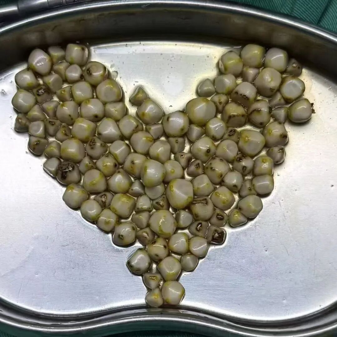 2025年度|四川结石病医院肝胆外科：深耕亚专科，绘就精准医疗蓝图(图2)