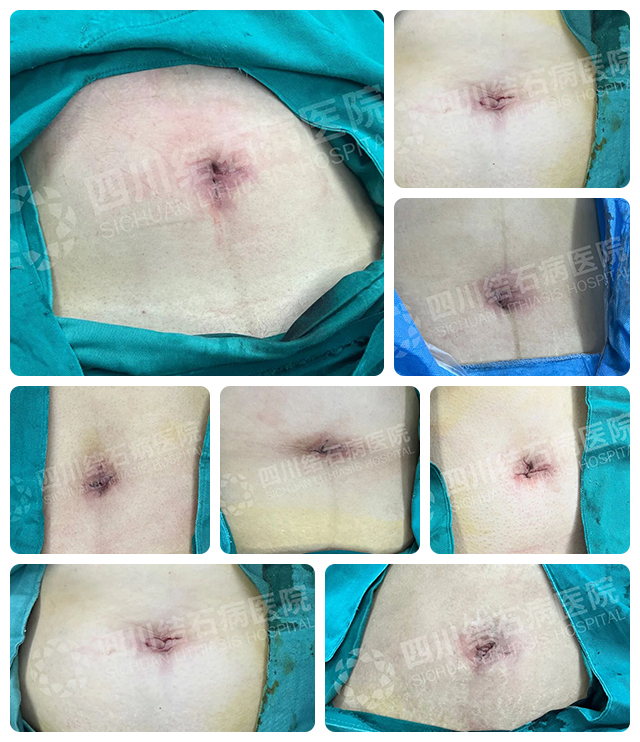 2025年度|四川结石病医院肝胆外科：深耕亚专科，绘就精准医疗蓝图(图9)